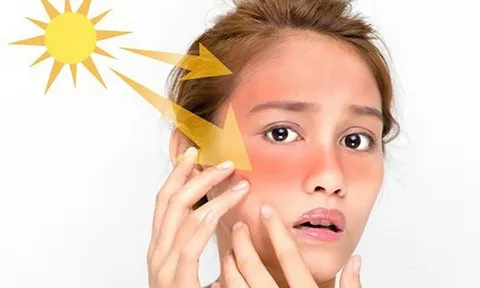 Dùng kem chống nắng đúng cách để bảo vệ làn da hiệu quả