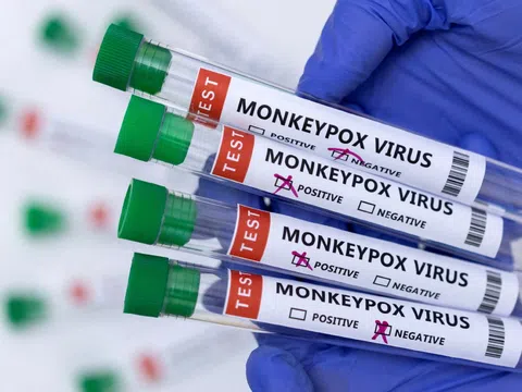 Cách phòng ngừa bệnh đậu mùa khỉ để có chuyến du lịch an toàn